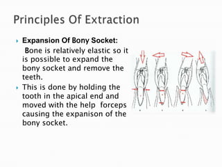  Loosening of soft tissue attachement around
the tooth:
• It is done using the no:9 peioteal elevator.The
instrument has ...