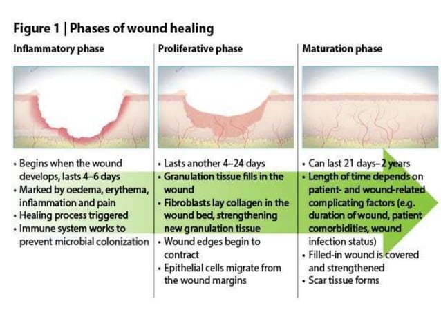 Department of oral & maxillofacial surgery (Wound healing ) | PPTX ...