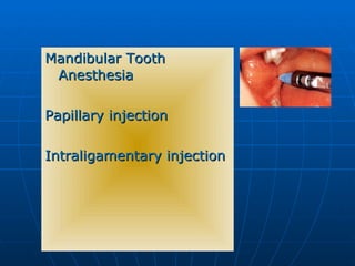 Intrapulpal Injection Front Tooth Approach to Dentistry - Oral and Maxillofacial Surgery | PPT