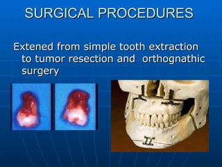 Approach to Dentistry - Oral and Maxillofacial Surgery | PPT
