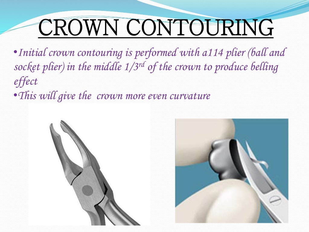 Stainless Steel Crown (Department of pedodontics)