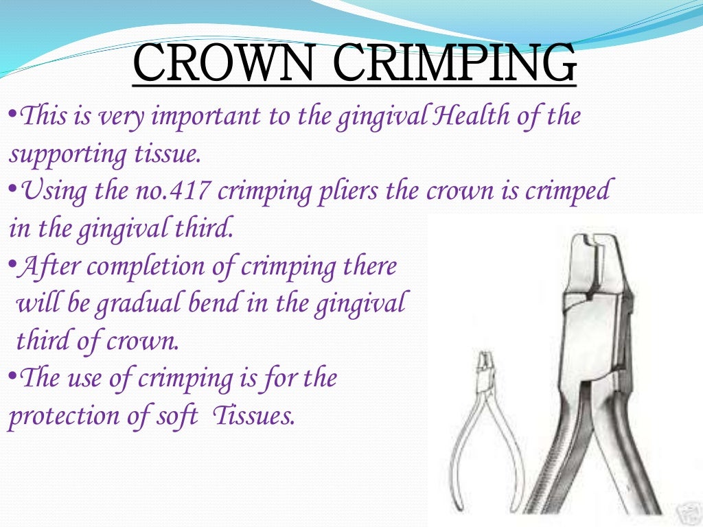 Stainless Steel Crown (Department of pedodontics)