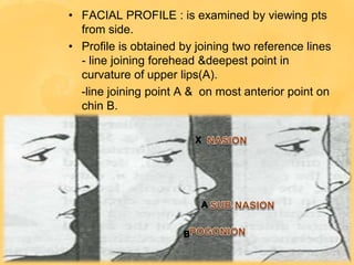 • FACIAL PROFILE : is examined by viewing pts
from side.
• Profile is obtained by joining two reference lines
- line joining forehead &deepest point in
curvature of upper lips(A).
-line joining point A & on most anterior point on
chin B.
1.
 
