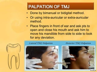 • Done by bimanual or bidigital method.
• Or using intra-auricular or extra-auricular
method.
• Place fingers in front of ear and ask pts to
open and close his mouth and ask him to
move his mandible from side to side to look
for any deviation.
 