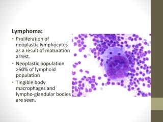 Lymphoma:
• Proliferation of
neoplastic lymphocytes
as a result of maturation
arrest.
• Neoplastic population
>50% of lymphoid
population
• Tingible body
macrophages and
lympho-glandular bodies
are seen.
 