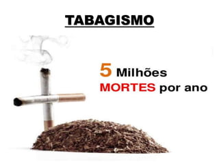 TABAGISMO
 