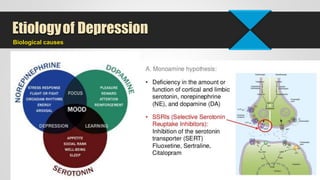 Biological causes
Etiologyof Depression
 