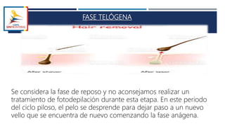 FASE TELÓGENA
Se considera la fase de reposo y no aconsejamos realizar un
tratamiento de fotodepilación durante esta etapa. En este periodo
del ciclo piloso, el pelo se desprende para dejar paso a un nuevo
vello que se encuentra de nuevo comenzando la fase anágena.
 