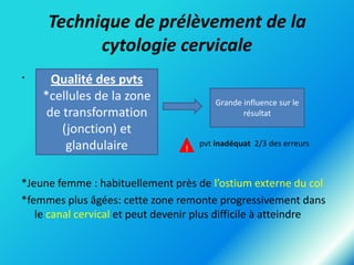 Technique de prélèvement de la
cytologie cervicale
.

Qualité des pvts
*cellules de la zone
de transformation
(jonction) et
glandulaire

Grande influence sur le
résultat

!

pvt inadéquat 2/3 des erreurs

*Jeune femme : habituellement près de l’ostium externe du col
*femmes plus âgées: cette zone remonte progressivement dans
le canal cervical et peut devenir plus difficile à atteindre

 