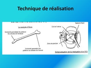 Technique de réalisation

 