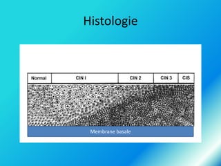 Histologie

Membrane basale

 