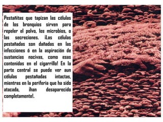 Pestañitas que tapizan las células
de los bronquios sirven para
repeler el polvo, los microbios, o
las secreciones. ¡Las células
pestañadas son dañadas en las
infecciones ó en la aspiración de
sustancias nocivas, como esas
contenidas en el cigarrillo! En la
parte central se puede ver aun
células    pestañadas      intactas,
mientras en la periferia que ha sido
atacada,     ¡han      desaparecido
completamente!.
 