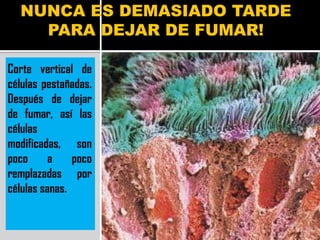 NUNCA ES DEMASIADO TARDE
    PARA DEJAR DE FUMAR!

Corte vertical de
células pestañadas.
Después de dejar
de fumar, así las
células
modificadas, son
poco      a    poco
remplazadas por
células sanas.
 