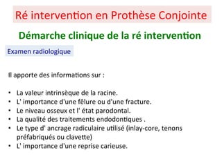 Il apporte des informa+ons sur :
• La valeur intrinsèque de la racine.
• L' importance d'une fêlure ou d'une fracture.
• Le niveau osseux et l' état parodontal.
• La qualité des traitements endodon+ques .
• Le type d' ancrage radiculaire u+lisé (inlay-core, tenons
préfabriqués ou clavePe)
• L' importance d'une reprise carieuse.
Ré interven+on en Prothèse Conjointe
Démarche clinique de la ré interven;on
Examen radiologique
 