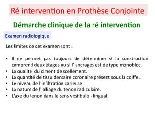 Les limites de cet examen sont :
• Il ne permet pas toujours de déterminer si la construc+on
comprend deux étages ou si l’ ancrages est de type monobloc.
• La qualité du ciment de scellement.
• La quan+té de +ssu dentaire coronaire présent sous la coiﬀe .
• Le niveau de l'inﬁltra+on carieuse .
• La nature de l' alliage du tenon radiculaire.
• L'axe du tenon dans le sens ves+bulo - lingual.
Ré interven+on en Prothèse Conjointe
Démarche clinique de la ré interven;on
Examen radiologique
 