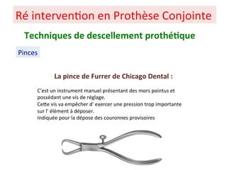 Ré interven+on en Prothèse Conjointe
Pinces
Techniques de descellement prothé;que
La pince de Furrer de Chicago Dental :
C'est un instrument manuel présentant des mors pointus et
possédant une vis de réglage.
CePe vis va empêcher d' exercer une pression trop importante
sur l' élément à déposer.
Indiquée pour la dépose des couronnes provisoires
 