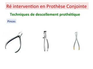 Ré interven+on en Prothèse Conjointe
Pinces
Techniques de descellement prothé;que
 