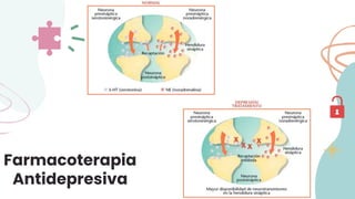 Farmacoterapia
Antidepresiva
 