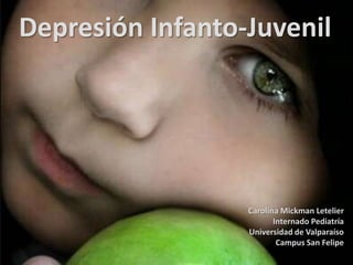 Depresión Infanto-Juvenil
Carolina Mickman Letelier
Internado Pediatría
Universidad de Valparaíso
Campus San Felipe
 