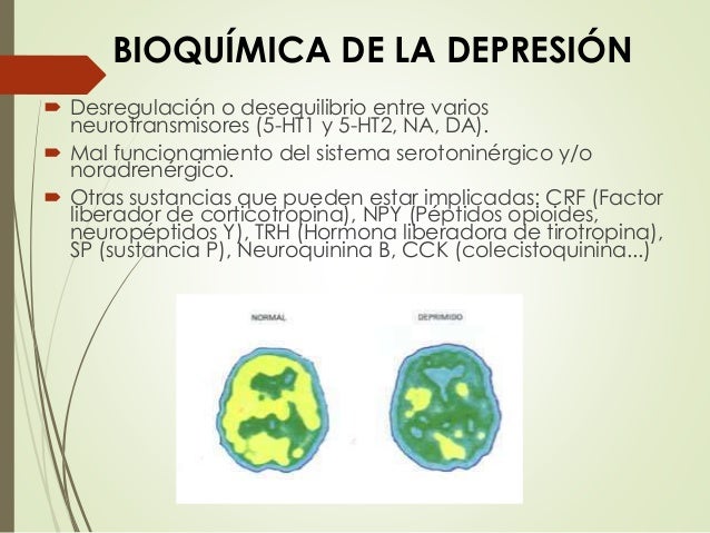 depresion-dr-pizarro-1-san-martin-1-29-638.jpg