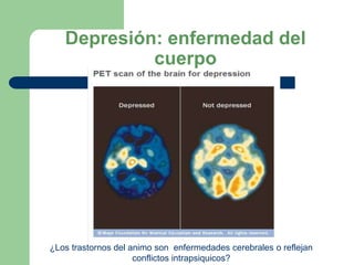 Depresión: enfermedad del
            cuerpo




¿Los trastornos del animo son enfermedades cerebrales o reflejan
                     conflictos intrapsiquicos?
 