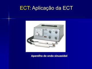 Aparelho de onda sinusoidal
ECT: Aplicação da ECT
 