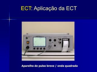 Aparelho de pulso breve / onda quadrada
ECT: Aplicação da ECT
 
