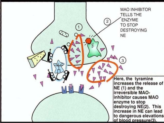 Ejaculatory inhibition Ejaculatory inhibition