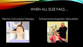 WHEN ALL ELSE FAILS… 
Electro Convulsive Therapy Transcranial Magnetic Stimulation 
 