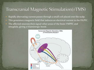  Rapidly alternating current passes through a small coil placed over the scalp.
 This generates a magnetic field that induces an electrical current in the DLPFC.
 The affected neurons then signal other areas of the brain VMPFC and
amygdala, giving a triaminergic boost.
 
