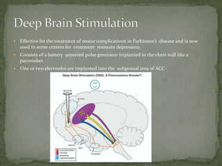  Effective for the treatment of motor complications in Parkinson’s disease and is now
used in some centers for treatment resistant depression.
 Consists of a battery -powered pulse generator implanted in the chest wall like a
pacemaker.
 One or two electrodes are implanted into the subgenual area of ACC .
 