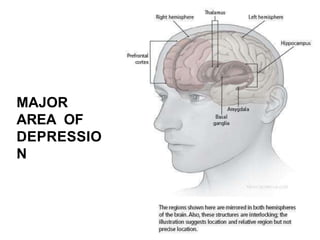 MAJOR
AREA OF
DEPRESSIO
N
 