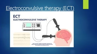 Electroconvulsive therapy (ECT)
 