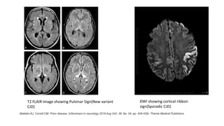 Depression and Psychosis in Neurological Practice.pptx
