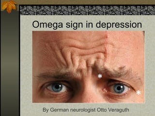 Omega sign in depression
By German neurologist Otto Veraguth
 