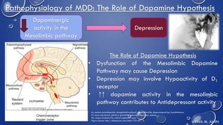 Major Depressive Disorder (MDD) | PDF