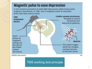 17
TMS working and principle
 