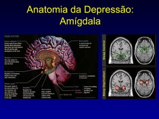 Anatomia da Depressão: Amígdala 