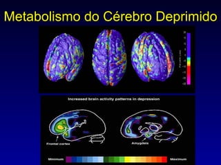 Metabolismo do Cérebro Deprimido 