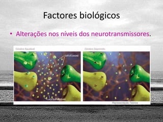 Factores biológicos
• Alterações nos níveis dos neurotransmissores.
 