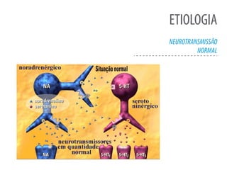 ETIOLOGIA
NEUROTRANSMISSÃO
NORMAL
 