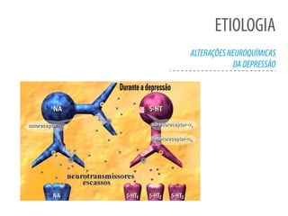 ETIOLOGIA
ALTERAÇÕESNEUROQUÍMICAS
DADEPRESSÃO
 