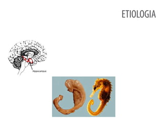 ETIOLOGIA
 