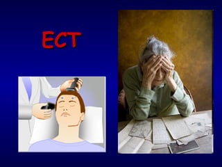 ECT 