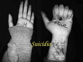 Suicídio
 