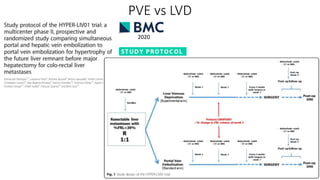 PVE vs LVD
2020
 
