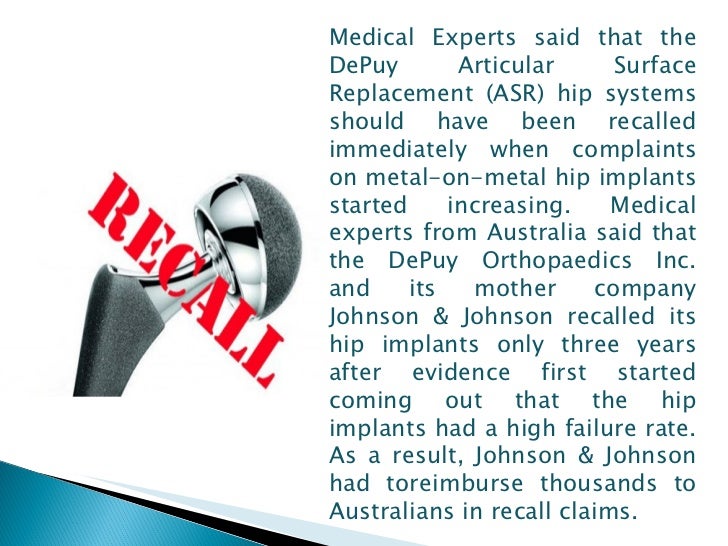 Depuy Asr Hip Replacement Should Have Been Recalled Earlier