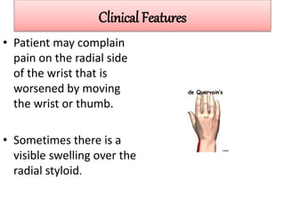 Clinical Features
• Patient may complain
pain on the radial side
of the wrist that is
worsened by moving
the wrist or thumb.
• Sometimes there is a
visible swelling over the
radial styloid.
 