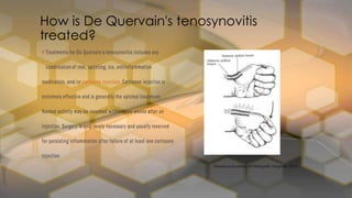 How is De Quervain's tenosynovitis
treated?
 