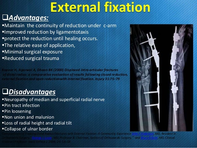 External fixation versus volar locking plate for displaced intra-arti…